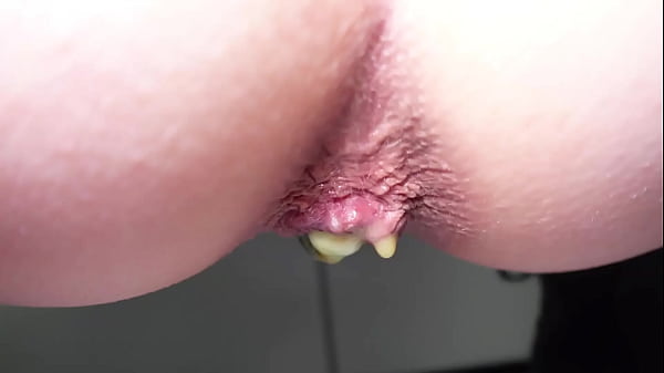 Anyone want gummy bears from my asshole?