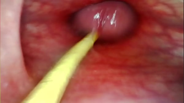 EXTREME ANAL POV. CAMERA INSIDE HER ASSHOLE AS I POUND HER WITH MY BIG COCK AND CUM DEEP INSIDE